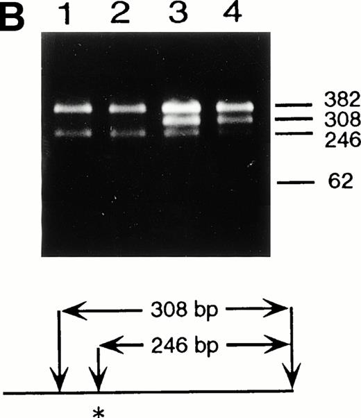 Fig. 2. Identification of the maternal mutation at the splice donor site in intron 2. (A) Sequence (sense) of the exon 2/intron 2 junction in amplified genomic DNA. Genomic fragments containing exon 2 were amplified from a control (left) and the patient (right) and sequenced directly. A mutation at the splice donor site in intron 2 (G+1 → A) is indicated by arrows. (B) Detection of the splice site mutation by the BspMI digestion. Amplified genomic fragments (690 bp) from intron 1 (bp 14,901) to intron 2 (base pair 15,590) was digested with BspMI, electrophoresed in 2.0% agarose gel, and stained with ethidium bromide. The fragment has twoBspMI recognition sites at bp 15,282 and 15,344, predicting 62-, 246-, and 382-bp fragments in the control lane. Loss of theBspMI site (base pair 15,282) by the mutation results in the undigested fragment (308 bp). Lane 1, control; lane 2, father; lane 3, mother; and lane 4, patient. BspMI digestion shows the patient and his mother were heterozygous for the splice site mutation.