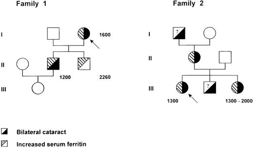 Fig. 1. Pedigree of two families with the hereditary hyperferritinemia-cataract syndrome. Within each symbol, the left part indicates serum ferritin level and the right part the lens status. Serum ferritin levels are indicated in micrograms per liter. A question mark denotes an unknown serum ferritin level. Probands are identified by an arrow.