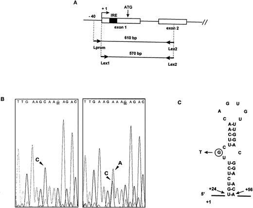 Fig. 2. Identification of the mutation in the IRE of the L ferritin gene. (A) Schematic representation of the functional L ferritin gene on chromosome 19q13.3-q13.4 and position of the primers used for the PCR amplification. (B) Sequence analysis of genomic DNA from a normal individual (left) and from patient III1 in Family 2 (right). Comparison of the sequence of the reverse strand reveals a C to A mutation at the heterozygous state in the patient DNA. (C) Predicted secondary structure of the IRE in the L ferritin mRNA and position of the mutation in the 5′ UGC bulge. Numbering is from the first nucleotide in exon 1.
