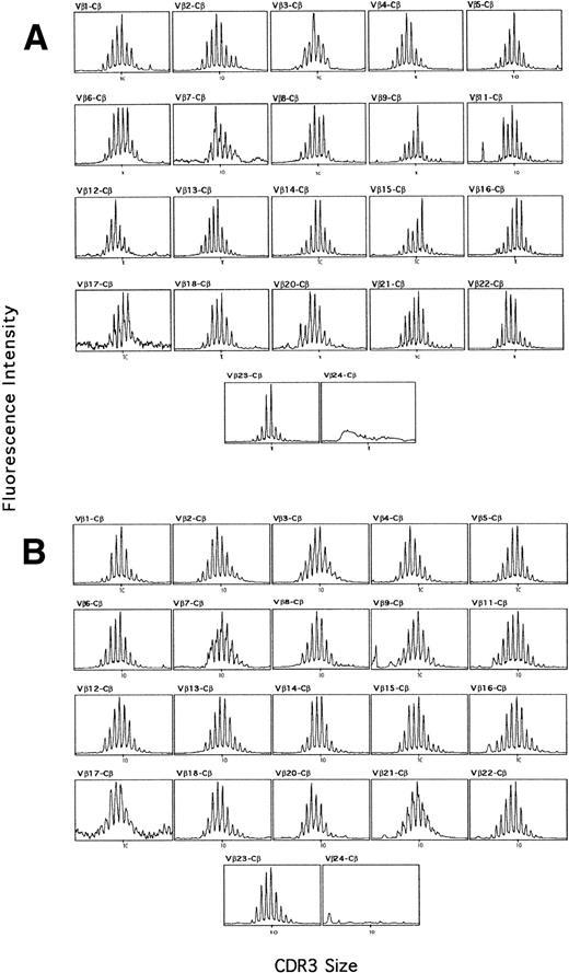 Fig. 1. TCR β-chain transcript CDR3 size distribution patterns from a representative adult (A) and CB (B) sample. cDNA was amplified in PCR reactions primed by one BV subfamily and the BC specific primer. The amplification products were copied in run-off reaction primed by a nested fluorescent BC specific primer, and the labeled DNA copies were analyzed on a sequencing gel in an automated DNA sequencer.