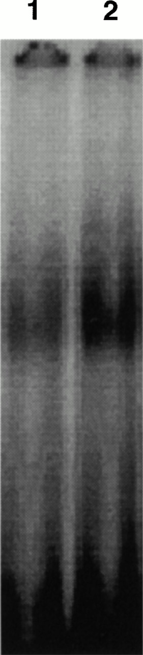 Fig. 6. EMSA of CD28RC in OKT3-stimulated CD4 cells derived from unfractionated or CD14-depleted G-PBMCs. A total of 1 × 106/mL unfractionated G-PBMCs and CD14 depleted G-PBMCs were cultured in OKT3-coated T75 culture flasks for 4 hours. One microgram of nuclear extract isolated from CD4 cells derived from either unfractionated (lane 1) or CD14-depleted (lane 2) G-PBMCs was used for EMSA. Results shown are generated from the same sample used in the experiment shown in Fig 5.