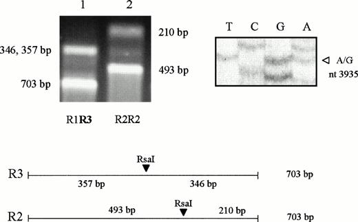 Fig. 1. Detection and characterization of a new polymorphic marker in exon 13. Upper left, separation by electrophoresis of the PCR product digested with Rsa I. The gel (2% agarose) was run at 70 V for 1 hour. Lane 1, subject heterozygous for the R3 allele and for the frequent R1 allele. Lane 2, subject homozygous for the R2 allele. The restriction map for R2 and R3 alleles is reported below. Upper right, detection of the R3 polymorphism by sequencing. The A/G transition is indicated by the open arrow. Nucleotide numbering according to Jenny et al.3