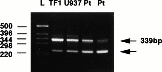 Fig. 1. RT-PCR analysis of the GMRβC chain between nucleotides 1281 and 1620 of the published sequence17 using RNA from hematopoietic cell lines (TF-1 and U937) and leukemic blasts of 2 patients with AML (Pt). L, ladder. Primers 1 and 2 were used (Table 1), and the expected fragment size was 339 bp.