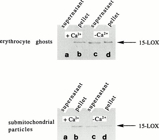 Fig. 1. Calcium-dependent membrane binding of the rabbit reticulocyte lipoxygenase in vitro. The purified rabbit 15-LOX (30 nanokatals/mL) was incubated for 5 minutes with erythrocyte ghosts (2 mg/mL) and SMP (1 mg/mL) in the presence (0.5 mmol/L) and absence of calcium chloride. Sample work-up, electrophoresis, and immunoblotting are described in Materials and Methods. (A) Supernatant in the presence of calcium, (B) membrane pellet in the presence of calcium, (C) supernatant in the absence of calcium, (D) membrane pellet in the absence of calcium.