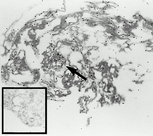 Fig. 3. Immunogold labeling of the 15-lipoxygenase in rabbit reticulocytes. Cells were prepared and stained as described in the Materials and Methods section, 24,300-fold magnification. Inset, staining with a nonimmuno-IgG preparation; 27,100-fold magnification.
