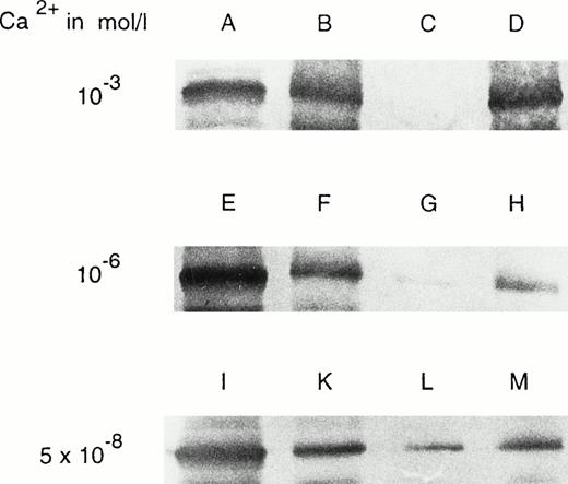 Fig. 4. Cell fractionation studies of rabbit reticulocytes at various calcium concentrations. Cell preparation, hemolysis, sample work-up, and immunoblotting are described in the Materials and Methods section. (A) Cytosol fraction; (B) membrane pellet; (C) supernatant of washing (washed at 10−3 mol/L calcium); (D) washed membrane pellet (washed at 10−3 mol/L calcium); (E) cytosol fraction; (F) membrane pellet; (G) supernatant of washing (washed at 10−6 mol/L calcium); (H) washed membrane pellet (washed at 10−6 mol/L calcium); (I) cytosol; (K) membrane pellet; (L) supernatant of washing (washed at 5 × 10−8 mol/L calcium); (M) washed membrane pellet (washed at 5 × 10−8 mol/L calcium).