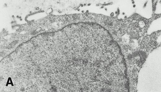 Fig. 6. Intracellular distribution of the 15-lipoxygenase in IL-4–treated monocytes. Cell preparation, immunoperoxidase staining, and electron microscopy are described in Materials and Methods. (A) Control monocytes (no IL-4 treatment) incubated with a nonimmune rabbit IgG preparation; 10,500-fold magnification; (B) IL-4–treated monocyte, 9,200-fold magnification. Here the cells were stained with a polyclonal anti–15-LOX antibody (IgG fraction). Arrows indicate the localization of the enzyme at the membranes of subcellular vesicles. Arrowheads indicate the localization at the cytosolic side of the plasma membrane.
