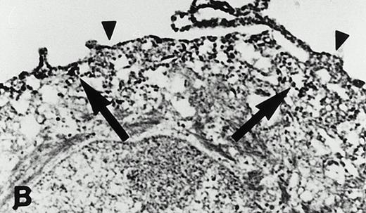 Fig. 6. Intracellular distribution of the 15-lipoxygenase in IL-4–treated monocytes. Cell preparation, immunoperoxidase staining, and electron microscopy are described in Materials and Methods. (A) Control monocytes (no IL-4 treatment) incubated with a nonimmune rabbit IgG preparation; 10,500-fold magnification; (B) IL-4–treated monocyte, 9,200-fold magnification. Here the cells were stained with a polyclonal anti–15-LOX antibody (IgG fraction). Arrows indicate the localization of the enzyme at the membranes of subcellular vesicles. Arrowheads indicate the localization at the cytosolic side of the plasma membrane.