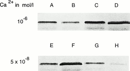 Fig. 7. Cell fractionation studies of IL-4–treated monocytes at various calcium concentrations. Cell preparation, sample work-up, and immunoblotting are described in Materials and Methods. Cell lysis was performed at two calcium concentrations (10−6 mol/L for A through D and 5 × 10−8 mol/L for E through H). After lysis, the membranes were spun down at 100,000g. The membrane pellet and the supernatant of the 100,000g centrifugation, which was considered the cytosol, were prepared for electrophoresis as described in the Materials and Methods section. (A) Membrane pellet; (B) cytosol; (C) washing supernatant (washed at 10−6mol/L calcium); (D) washed membrane pellet (washed at 10−6 mol/L calcium); (E) membrane pellet; (F) cytosol; (G) washing supernatant (washed at 5 × 10−8 mol/L calcium); (H) washed membrane pellet (washed at 5 × 10−8 mol/L calcium).