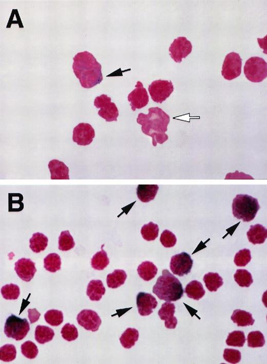 Fig. 3. (A) Representative field from a cytospin preparation of buffy coat from a normal mouse, stained as described in Materials and Methods. Black arrow indicates a monocyte identified by the dark blue precipitate. White arrow indicates a neutrophil nucleus (final magnification × 1,000). (B) Representative field from a cytospin preparation of buffy coat from a mouse treated with M-CSF, 4 mg/kg/d, for 4 days. Cells were stained as described in Materials and Methods. Black arrows indicate six monocytes identified by the dark blue precipitate. Note the relative increase in the number of monocytes (final magnification × 1,000).