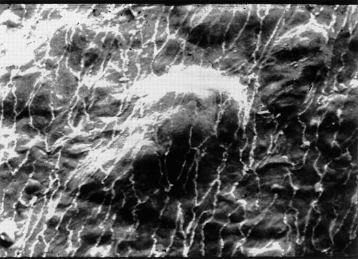 Fig. 4. Very early development of atherosclerosis in a nonhuman primate. The focal origin of atherosclerosis is apparent beneath an intact endothelium. Scanning electron microscopy of ECs outlined by silver deposition in a thoracic aorta (photograph courtesy of Peter F. Davies, PhD, Institute for Medicine and Engineering, University of Pennsylvania, Philadelphia, PA).