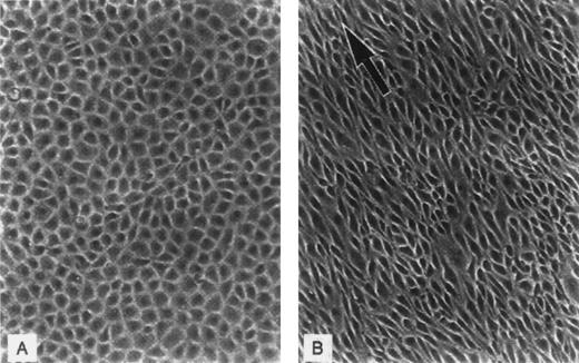 Fig. 5. EC alignment by directional steady flow in vitro (photographs courtesy of Peter F. Davies, PhD, Institute for Medicine and Engineering, University of Pennsylvania, Philadelphia, PA). (A) Before exposure to shear stress (no flow). (B) Twenty-four hours after exposure to flow (shear stress, 10 dynes/cm2).