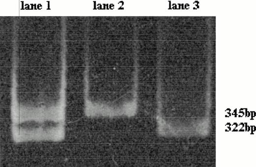 Fig. 1. Polyacrylamide gel electrophoresis of the amplified 345-bp fragment of factor II gene after HindIII digestion; the mutant factor II gene has a restriction site for HindIII leading to the production of two 322- and 23-bp fragments (the latter not detectable here). The wild-type factor II gene is characterized by the presence of the only 345-bp fragment (lane 2). The mutant factor II gene heterozygous genotype (lane 1) is characterized by two fragments of 345 bp (wild-type allele) and 322 bp (mutant allele); the homozygous genotype shows only a 322-bp fragment (lane 3).
