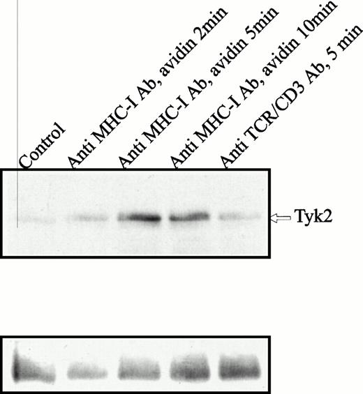 Fig. 1. Immunoprecipitates of Tyk2 obtained from lysates of Jurkat 76.25 cells after MHC-I or TCR/CD3 ligation. Cells (3 × 107) were preincubated with PBS (lane 1) or saturating amounts of anti-β2M Ab (lanes 2 through 4) before exposure to avidin for the indicated time (lanes 1 through 4) or exposed to anti-TCR/CD3 Abs (lane 5). Precipitates were immunoblotted with antiphosphotyrosine Ab (upper panel). Blots were stripped and reprobed with anti-Tyk2 Ab (lower panel).