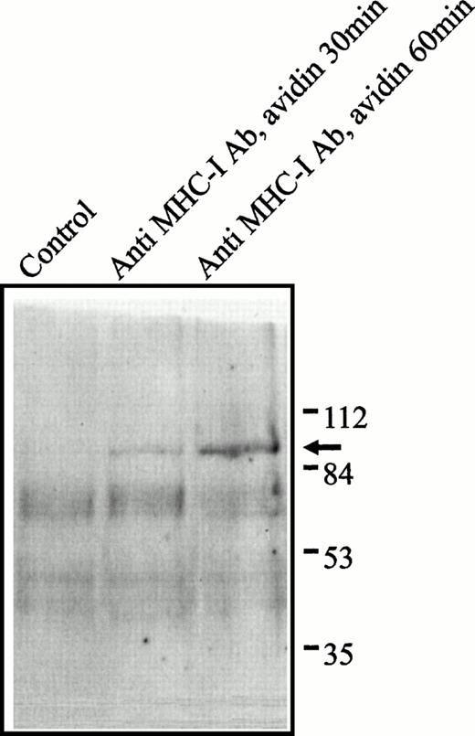 Fig. 3. Phosphotyrosine blot of the nuclear fraction of Jurkat 76.25 cells after MHC-I ligation. Cells (3 × 107) were preincubated with PBS (lane 1) or saturating amounts of anti-β2M Ab (lanes 2 and 3) before exposure to avidin for the indicated time. The separated proteins were immunoblotted with antiphosphotyrosine Ab.