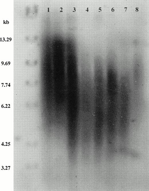 Fig. 1. Telomere shortening with age and in AA. Southern blot ofRsa I-digested genomic DNA from unfractionated peripheral blood leukocytes, probed with (TTAGGG)4. Positions of molecular weight markers are shown on the left. Tracks 1 through 5, normal donors: 1, age 29 years; 2, age 28 years; 3, age 90 years; 4, age 73 years; 5, age 66 years. Tracks 6 through 8, patients with acquired AA: 6, age 30 years, 99 months from diagnosis; 7, 43 years, 53 months from diagnosis; 8, 37 years, 4 months from diagnosis.
