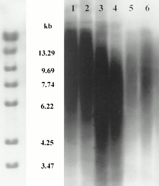 Fig. 5. Telomere length in separated granulocyte and mononuclear cell fractions. Southern blot of Rsa I-digested genomic DNA extracted from density gradient separated peripheral blood granulocytes or mononuclear (MN) cells, probed with (TTAGGG)4, showing equivalent results for both cell fractions. Positions of molecular weight markers are shown on the left. Tracks 1 and 2: MN (1) and granulocytes (2) from normal donor age 45 years; tracks 3 and 4: MN (3) and granulocytes (4) from normal donor age 54 years; tracks 5 and 6: MN (5) and granulocytes (6) from normal donor age 57 years.