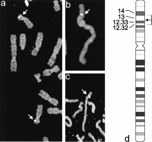 Fig. 4. Partial metaphases hybridized with biotin-labeled cubilin cDNA, showing (a) the specific FISH signals on the homologous chromosome 10p-regions (arrows) superimposed on the DAPI-stained chromosomes, (b and c) FISH signals on more elongated chromosomes, and (d) a chromosome ideogram31 showing the localization of the intrinsic factor receptor gene and the mean FLpter value (arrow). The box indicates the variation in Flpter values on individual chromosomes.