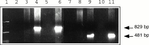 Fig. 4. PCR amplification of genomic DNA isolated from individualneoR hematopoietic colonies transduced with G1Na (lanes 3, 4, and 6) and LNL6 (lanes 8, 9, and 11) vectors. Samples were subjected to 30 cycles of amplification using primer pairs specific for G1Na (lanes 4 and 8), LNL6 (lanes 3 and 9), or both (lanes 6 and 11). Ethidium bromide–stained products of 829-bp and 481-bp DNA sequences indicate specific amplification by G1Na- and LNL6-specific primers, respectively. Molecular weight markers were loaded in lane 1, and lanes 2, 5, 7, and 10 were blank.