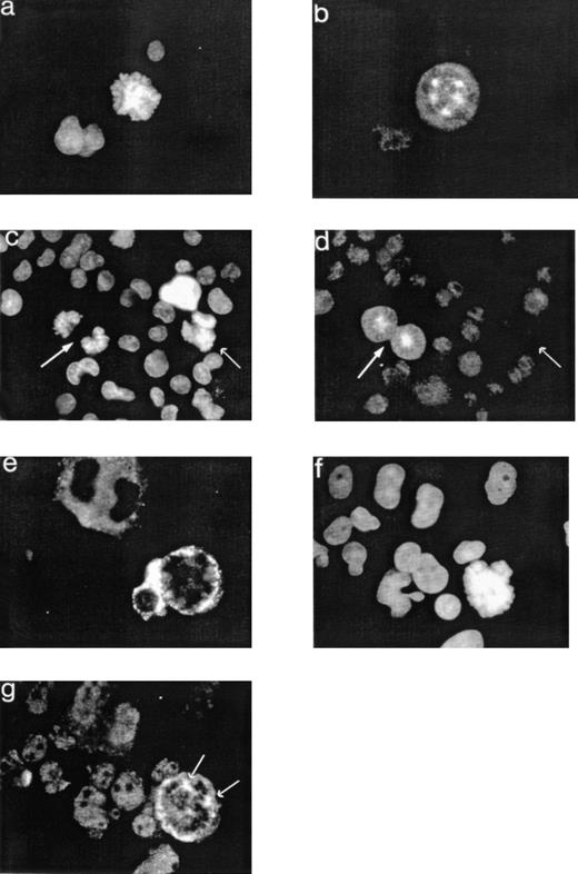 Fig. 5. Localization of cyclin B1 in endomitotic MKs. Cultures were performed as described in Fig 1 and cells were stained as described in Fig 3 by an anti-cyclin B1 polyclonal antibody (b and d; TRITC), an anti-vWF MoAb (e; FITC), and the Hoechst dye (a and c). They were examined by conventional fluorescent microscopy (original magnification × 500). In this polyploid MK in endomitosis (a), cyclin B1 staining draws the mitotic spindle with its multiple asters. In two MKs in metaphase, cyclin B1 is detectable (arrows on the left; c and d). In contrast, in a polyploid MK with an anaphase figure (arrow on the right; c and d) as shown by segregation of the chromatids, cyclin B1 is undetectable. In this endomitotic MK (f) expressing the vWF (e), cyclin B1 colocalized with the asters, as shown by the arrows.