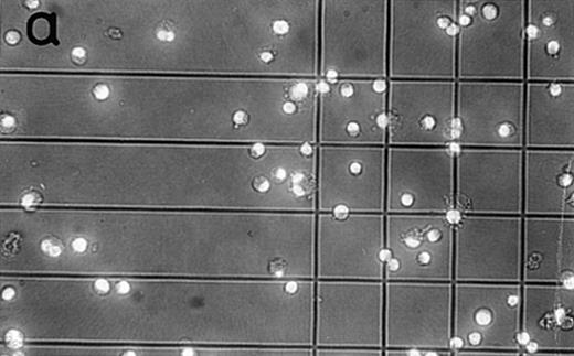 Fig. 6. Examination of sorted MKs. After 8 days of culture, the cells were sorted on their CD41 expression and on their ploidy by Hoechst staining into two cell fractions corresponding to 2N-4N and >4N MKs. The quality of the sorted cells was checked by examination with a fluorescence microscope (original magnification × 100) under UV light (a and b). The polyploid fraction with multilobulated nuclei (b) was slightly contamined by some cell agregates. In the 2N-4N fraction (a), the cells were smaller. Cells were also reanalyzed by flow cytometry. A typical experiment is shown in (c), (d), and (e). In (c), the ploidy histogram of the CD41+ cells before sorting is shown with 14% >4N MKs. The ploidy histogram of the 2N-4N cell fraction is shown in (d). The purity of this fraction is greater than 99.9%. In (e), the ploidy histogram of >4N is shown with a purity of greater than 93%. It is noteworthy that contaminant cells (5%) are only 2N cells. The width of the peak is slightly larger than in the unfractionated cells due to a slight efflux of the Hoechst during cell sorting.