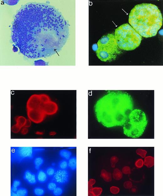 Fig. 2. Polyploid MKs in prometaphase. Cultures were performed as described in Fig 1, except that nocodazole (1 μg/mL) was added in some experiments to 8-day culture for 5 hours. Cells were stained either by May-Grünwald Giemsa or labeled by antibodies (FITC or TRITC) and counterstained by the Hoechst dye (blue) after cytocentrifugation and fixation. (a) This MK is blocked in pseudometaphase by nocodazole. Well-condensed, individualized chromosomes are present. The cytoplasm already has a granular pattern with purple staining localized to one pole of the cell that may correspond to granules (arrow). The nuclear envelope is not apparent. Original magnification × 2,000. (b) Two large MKs (appointed by arrow) are labeled by an anti-vWF antibody (FITC) and conterstained by Hoechst. These endomitotic MKs with condensed chromosomes are blocked in prometaphase. Original magnification × 1,000. (c) An MK in interphase is labeled by the human anti-lamin B antibody (TRITC). The polylobulated nucleus is surrounded by a distinct linear red labeling. Original magnification × 1,000. (d, e, and f) A polyploid MK in spontaneous metaphase is shown. Expression of vWF (FITC; d), Hoechst (e), and lamin B (TRITC; f). Only a faint and dispersed labeling is observed in TRITC, demonstrating that the nuclear envelope has disappeared.