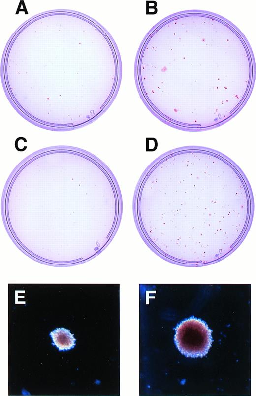 Fig. 1. Growth of erythroid colonies in agar culture after transduction of human CD34+ cells with LNL6 or LNC(SCL). (A) through (D) show agar culture plates of LNL6-transduced (A and C) or LNC(SCL)-transduced (B and D) CD34+ cells stimulated for erythroid colonies in the presence (A and B) or absence (C and D) of G418. CD34+ cells were cultured at 1,000 cells/mL in the absence of G418 (C and D) and at 104 cells/mL in the presence of G418 (A and B). Photographs were taken at day 13 of culture in agar. (E) and (F) show morphology of individual erythroid colonies (original magnification ×40) grown in the presence of G418 after transduction of CD34+ cells with LNL6 (E) or LNC(SCL) (F). The control erythroid colony shown in (E) was the largest colony in the culture, whereas that in (F) represents a typical erythroid colony. Colonies were photographed at day 13.
