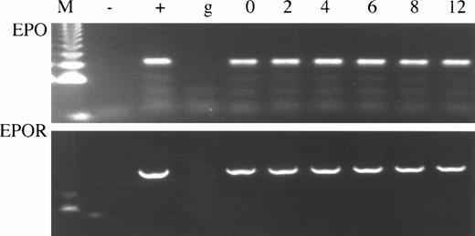 Fig. 1. Cultured CD34+ cells express EPO and EPOR mRNAs. CD34+ cells prepared by magnetic sorting22 were cultured with EPO to preferentially favor differentiation of erythroid progenitors and precursors.30Aliquots of cells were taken at days 0, 2, 4, 6, 8, and 12; total RNA was isolated; and EPO and EPOR cDNAs were generated by RT-PCR by using specific primers. Size marker 123 bp ladder (M), negative control (−), genomic DNA (g), EPO cDNA (+) upper panel, EPO cDNA (+) lower panel.