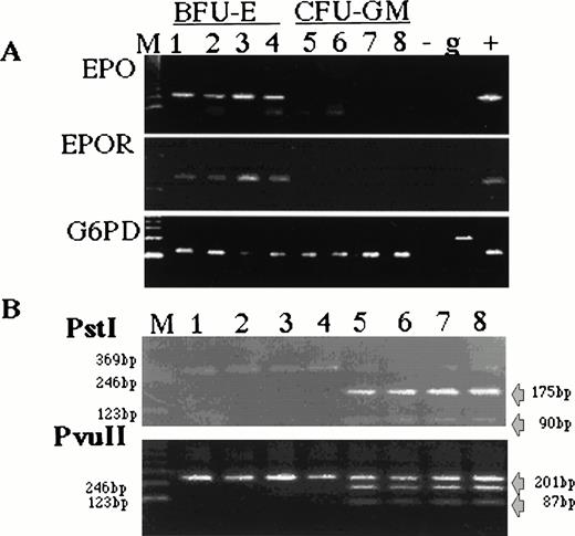 Fig. 3. Individual BFU-E but not CFU-GM colonies express EPO. (A) Individual erythroid BFU-E and nonerythroid CFU-GM colonies stimulated with EMP were harvested and analyzed by RT-PCR for EPO, EPOR, and G6PD. BFU-E colonies (lanes 1-4) contain EPO and EPOR mRNAs, and CFU-GM colonies (lanes 5-8) were negative. The housekeeping gene G6PD is expressed in both types of colonies. Size marker 123 bp ladder (M), negative control (−), genomic DNA (g), EPO, EPOR, or G6PD cDNA (+). (B) Restriction digestion analysis. EPO RT-PCR products prepared from individual BFU-E colonies (lanes 2-4) were digested (lanes 6-8) with either PstI (upper panel) or PvuII (lower panel). cDNA EPO template PCR product (lane 1) and its digest (lane 5). A similar restriction pattern in respect to the size of digested DNA (PstI digest, 175, 90, and 23 bp; PvuII digest, 201 and 87 bp) was obtained from all analyzed samples.