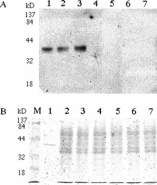 Fig. 4. BFU-E colonies express EPO protein. Bone marrow mononuclear cells were plated in semisolid media with either EPO or EMP. (A) BFU-E and CFU-GM colonies were pooled, washed, and lysed with Triton X-100–based lysis buffer. Lysates (20 μg per lane) were separated on 10% SDS-PAGE, transferred onto nitrocellulose membrane, and incubated with rabbit polyclonal anti-EPO antibody. A single band with comparable electrophoretic mobility to rhEPO (lane 1) was detected in BFU-E cells generated with EMP1 (lane 2) or with rhEPO (lane 3). The EPO-specific band was absent in Epstein-Barr virus–transformed lymphocytes (lane 4), granulocytes (lane 5), monocytes (lane 6), and CFU-GM colonies (lane 7). The same membrane was reprobed with antibodies against abundantly expressed angiotensin receptor type 1 (also expressed in BFU-E colony cells)26and a specific band of comparable intensity was detected in all samples. (B) Coomassie staining of protein lysates used on Western blots. To see electrophoretic migration rhEPO was loaded in excess of 50 U/lane.