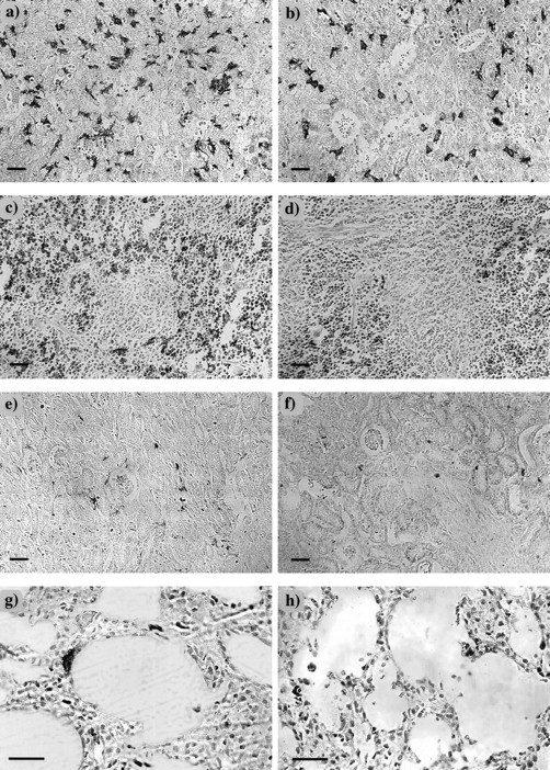 Fig. 3. F4/80-positive cells in neonatal tissues. Neonatal tissues (postnatal day 7) were stained for the macrophage marker, F4/80, as described in Fig 2, and counterstained with hematoxylin in liver (a and b), spleen (c and d), kidney (e and f), and lung (g and h) of +/csfmop (a, c, e, and g) and csfmop/csfmop (b, d, f, and h) newborn mice born to +/csfmop mothers. Original magnifications are ×110 (a through f) and ×230 (g and h), respectively. Bar = 50 μm.