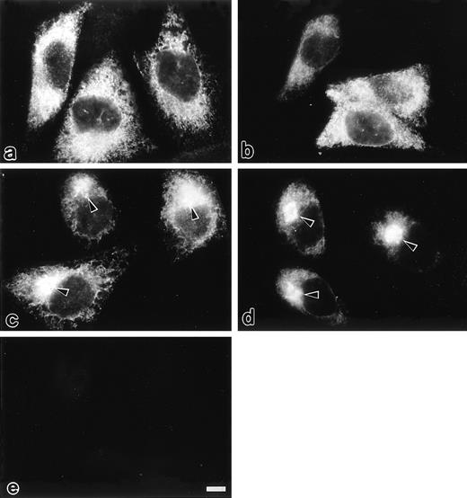Fig. 3. Immunofluorescence microscopic localization of different protein C variants transfected in the CHO cells protocols are described under Materials and Methods. In the cells expressing PC407 (a) and PC408 (b), cytoplasmic reticular staining was observed. In the cells expressing PC409 (c) and wtPC (d), a perinuclear spot with prominent brightness (arrow heads) was observed in addition to the cytoplasmic reticular staining. No immunofluorescence was detected in the mock-transfected CHO cells (e). Scale bars, 10 μm.