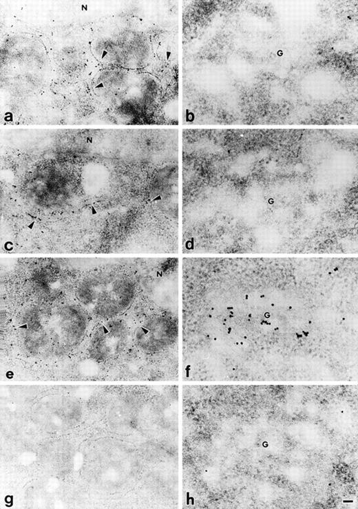 Fig. 4. Immunoelectron microscopic localization of different protein C variants transfected in the CHO cells. Transfected CHO cells were examined by postembedding immunoelectron microscopy using 10 nm colloidal gold-conjugated second antibody. In the cells expressing PC407 (a, b) and PC408 (c, d), gold particles were mainly distributed in rough ER (a, c), and no gold particles were localized to the Golgi apparatus (b, d). In the cells expressing PC409, gold particles were distributed in both rough ER (e) and Golgi apparatus (f). The mock-transfected CHO cells showed no specific immunolabelling (g, h). Arrowheads, rough ER; G, Golgi apparatus; N, nucleus. Scale bar, 100 nm for a, c, e and g; 50 nm for b, d, f and h.