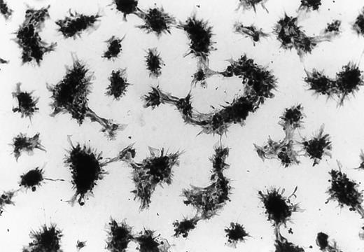 Fig. 1. Platelet adhesion to CRP 1-XL under static conditions (original magnification ×1,250).