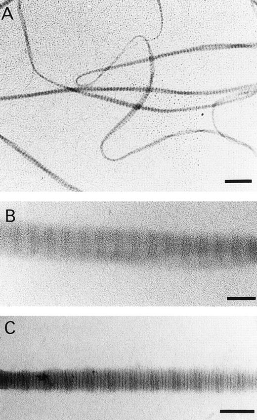 Fig. 2. (A) Transmission electronic micrographs of fibrils formed in vitro of human collagen type I. (A) and (B) were stained with phosphotungstate and (C) was stained with phoshotungstic acid and uranyl acetate. Bar in (A) = 0.5 μm. Bar in (B) and (C) = 0.1 μm.