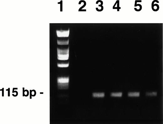 Fig. 1. PCR-generated KSHV cyclin D probes derived from BC-3 (lanes 3 to 6). Each lane represents a PCR reaction product. Reaction products were pooled before biotinylation. Hind III-digested lambda phage DNA and Hae III-digested ◊X174 DNA mixture used as a molecular weight standard (lane 1). The Hae III-digested ◊X174 DNA was labeled and used as the irrelevant specificity probe mixture, as these fragments were of similar size to the KSHV probe. H2O control (lane 2). PCR-generated probes were prepared and labeled as described in the text.