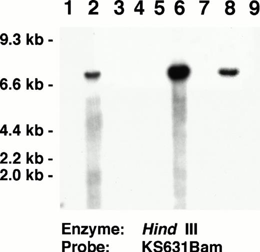 Fig. 4. Southern blot analysis identifying KSHV in AIDS-related NHL used as positive controls for the ISH experiments. Lanes 2, 6, 8:Hind III-digested DNA from AIDS-associated NHL containing KSHV-specific sequences identified by the KS631 probe. Lanes 3 to 5, 7, 9: AIDS-associated NHL lacking KSHV-specific sequences. Lane 1, Control DNA extracted from HL-60 promyelocytic leukemia cell line. Southern blots showing KSHV-specific sequences in the BC-1, BC-2, and BC-3 cell lines, which also were used as positive controls for ISH have been published previously.3336
