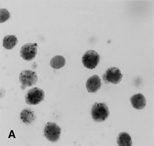 Fig. 5. KSHV cyclin expression in BC-3 and BJAB cell suspension mixtures. (A) 80% BC-3 (KSHV-positive), 20% BJAB (KSHV-negative); (B) 20% BC-3, 80% BJAB. These results show appropriate percentages of cells with punctate labeling indicating that diffusion of the label between cells, a possible artifact of PCR-ISH-based assays, does not occur in this procedure.