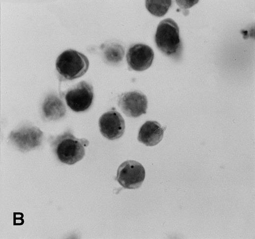 Fig. 5. KSHV cyclin expression in BC-3 and BJAB cell suspension mixtures. (A) 80% BC-3 (KSHV-positive), 20% BJAB (KSHV-negative); (B) 20% BC-3, 80% BJAB. These results show appropriate percentages of cells with punctate labeling indicating that diffusion of the label between cells, a possible artifact of PCR-ISH-based assays, does not occur in this procedure.