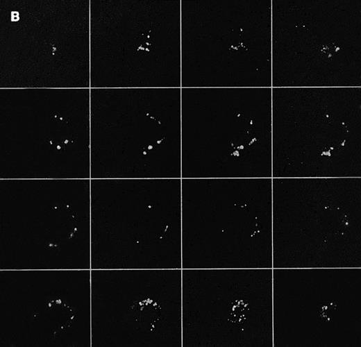 Fig. 1. Confocal analysis of PLCγ1 expression at the external leaflet of the plasma membrane in human T lymphocytes. (A) Unstimulated cell (increments of 0.85 μm in z-axis; cell size, 8 μm); (B) PHA-stimulated cell (increments of 0.9 μm in z-axis; cell size, 17 μm); (C) PHA-stimulated cell incubated for 90 minutes with interferon beta (increments of 0.75 μm in z-axis; cell size, 14 μm). (D) PHA-stimulated cell incubated for 24 hours with interferon beta (increments of 0.54 μm in z-axis; cell size, 10 μm); (E) cell labeled with anti-Leu-5b MoAb (CD 2), used as an internal control (increments of 0.56 μm in z-axis; cell size, 11 μm). Note that the membrane labeling evident in resting lymphocytes became weaker in PHA-stimulated cells, and again was strongly detectable after addition of interferon. As internal controls, cells were incubated with anti-Leu-5b MoAb, a T-lymphocyte surface marker, which strongly labeled the membranes (Fig 2E), while the reactions performed in the absence of the primary antibody yielded consistently negative results. Results obtained by incubating lymphocytes with anti-STAT 91/84 protein as an intracellular marker (to check membrane integrity) and with anti-PLC β and δ isoforms did not disclose any FITC membrane labeling.