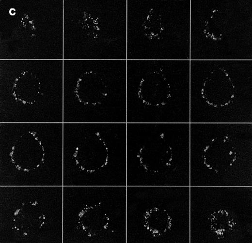 Fig. 1. Confocal analysis of PLCγ1 expression at the external leaflet of the plasma membrane in human T lymphocytes. (A) Unstimulated cell (increments of 0.85 μm in z-axis; cell size, 8 μm); (B) PHA-stimulated cell (increments of 0.9 μm in z-axis; cell size, 17 μm); (C) PHA-stimulated cell incubated for 90 minutes with interferon beta (increments of 0.75 μm in z-axis; cell size, 14 μm). (D) PHA-stimulated cell incubated for 24 hours with interferon beta (increments of 0.54 μm in z-axis; cell size, 10 μm); (E) cell labeled with anti-Leu-5b MoAb (CD 2), used as an internal control (increments of 0.56 μm in z-axis; cell size, 11 μm). Note that the membrane labeling evident in resting lymphocytes became weaker in PHA-stimulated cells, and again was strongly detectable after addition of interferon. As internal controls, cells were incubated with anti-Leu-5b MoAb, a T-lymphocyte surface marker, which strongly labeled the membranes (Fig 2E), while the reactions performed in the absence of the primary antibody yielded consistently negative results. Results obtained by incubating lymphocytes with anti-STAT 91/84 protein as an intracellular marker (to check membrane integrity) and with anti-PLC β and δ isoforms did not disclose any FITC membrane labeling.