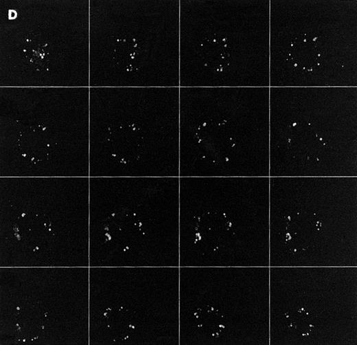 Fig. 1. Confocal analysis of PLCγ1 expression at the external leaflet of the plasma membrane in human T lymphocytes. (A) Unstimulated cell (increments of 0.85 μm in z-axis; cell size, 8 μm); (B) PHA-stimulated cell (increments of 0.9 μm in z-axis; cell size, 17 μm); (C) PHA-stimulated cell incubated for 90 minutes with interferon beta (increments of 0.75 μm in z-axis; cell size, 14 μm). (D) PHA-stimulated cell incubated for 24 hours with interferon beta (increments of 0.54 μm in z-axis; cell size, 10 μm); (E) cell labeled with anti-Leu-5b MoAb (CD 2), used as an internal control (increments of 0.56 μm in z-axis; cell size, 11 μm). Note that the membrane labeling evident in resting lymphocytes became weaker in PHA-stimulated cells, and again was strongly detectable after addition of interferon. As internal controls, cells were incubated with anti-Leu-5b MoAb, a T-lymphocyte surface marker, which strongly labeled the membranes (Fig 2E), while the reactions performed in the absence of the primary antibody yielded consistently negative results. Results obtained by incubating lymphocytes with anti-STAT 91/84 protein as an intracellular marker (to check membrane integrity) and with anti-PLC β and δ isoforms did not disclose any FITC membrane labeling.