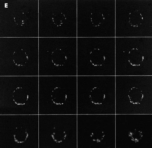 Fig. 1. Confocal analysis of PLCγ1 expression at the external leaflet of the plasma membrane in human T lymphocytes. (A) Unstimulated cell (increments of 0.85 μm in z-axis; cell size, 8 μm); (B) PHA-stimulated cell (increments of 0.9 μm in z-axis; cell size, 17 μm); (C) PHA-stimulated cell incubated for 90 minutes with interferon beta (increments of 0.75 μm in z-axis; cell size, 14 μm). (D) PHA-stimulated cell incubated for 24 hours with interferon beta (increments of 0.54 μm in z-axis; cell size, 10 μm); (E) cell labeled with anti-Leu-5b MoAb (CD 2), used as an internal control (increments of 0.56 μm in z-axis; cell size, 11 μm). Note that the membrane labeling evident in resting lymphocytes became weaker in PHA-stimulated cells, and again was strongly detectable after addition of interferon. As internal controls, cells were incubated with anti-Leu-5b MoAb, a T-lymphocyte surface marker, which strongly labeled the membranes (Fig 2E), while the reactions performed in the absence of the primary antibody yielded consistently negative results. Results obtained by incubating lymphocytes with anti-STAT 91/84 protein as an intracellular marker (to check membrane integrity) and with anti-PLC β and δ isoforms did not disclose any FITC membrane labeling.