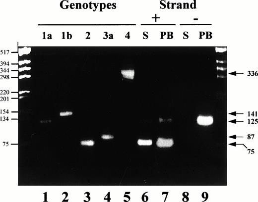 Fig. 1. Analysis of the genotype distribution in the serum and PBMC of a HCV patient harboring a dual infection. Nested RT-PCR was performed using Cap derived primers for the amplification of genotype specific products either from the positive or the negative strand viral RNA. Control human sera included positive strand RNA amplified from patients infected with genotypes 1a, 1b, 2(a/c), 3 and 4 (lanes 1, 2, 3, 4, and 5, respectively). Serum (S, lanes 6 and 8) and total PBMC (PB, lanes 7 and 9) from a patient infected with a genotype 1a and a genotype 2 were used for amplification of both the positive (+) and the negative (−) strand RNA. PCR products were fractionated on a 3% agarose gel and stained by ethidium bromide. Markers are shown on the left hand side (base pair, bp) while expected sizes of amplified products specific for the different genotypes are shown on the right hand side (bp).