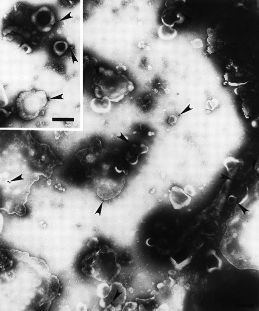 Fig. 2. Electron micrograph of immunogold-labeled Fas-bearing vesicles shed from MIP-101 cells. Fas (arrowheads) was detected with gold particle-conjugated antimouse anti-Fas antibody. The micrograph is at 57,000× magnification and the inset is at 68,000× magnification; scale bar = 0.2 μm.