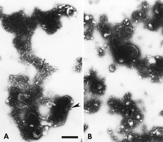 Fig. 3. Electron micrographs of vesicles shed from CX-1 cells. Large arrowheads point to gold particles in association with Fas antigen on plasma membrane-derived vesicles. In (A), a few gold particles (small arrowheads) not associated with vesicles can be seen and apparently represent nonspecific background. Both micrographs are at 92,000× magnification. Scale bar = 0.2 μm.