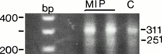 Fig. 9. Detection of Fas antigen splice variants in MIP-101 (MIP) and CX-1 (C) cells by RT-PCR. Two transcripts of 311 and 251 bp corresponding to the membrane-bound form and soluble form of Fas antigen, respectively, are amplified after PCR of first-strand cDNA. PCR products were electrophoresed in 2% agarose and visualized under UV light after staining with ethidium bromide. Note that the intensity of both bands is lower for CX-1 relative to MIP-101 cells, suggesting decreased presence of FAS mRNA in the latter cell line. Also note that the 251-bp band is less intense then the 311-bp band, suggesting that the membrane-bound form of Fas predominates in CX-1 and MIP-101 cells.