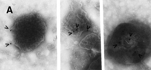 Fig. 12. Electron micrographs of vesicles shed from HuT 78 cells. Arrowheads point to gold particles in association with FasL on plasma membrane-derived vesicles (A). No labeling is observed if vesicles are treated with immunogold particle-conjugated antibody alone (B). Micrograph (A) is 102,000× magnification and micrograph (B) is at 63,000× magnification.