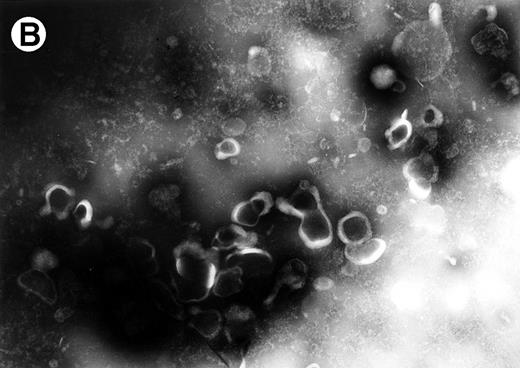 Fig. 12. Electron micrographs of vesicles shed from HuT 78 cells. Arrowheads point to gold particles in association with FasL on plasma membrane-derived vesicles (A). No labeling is observed if vesicles are treated with immunogold particle-conjugated antibody alone (B). Micrograph (A) is 102,000× magnification and micrograph (B) is at 63,000× magnification.