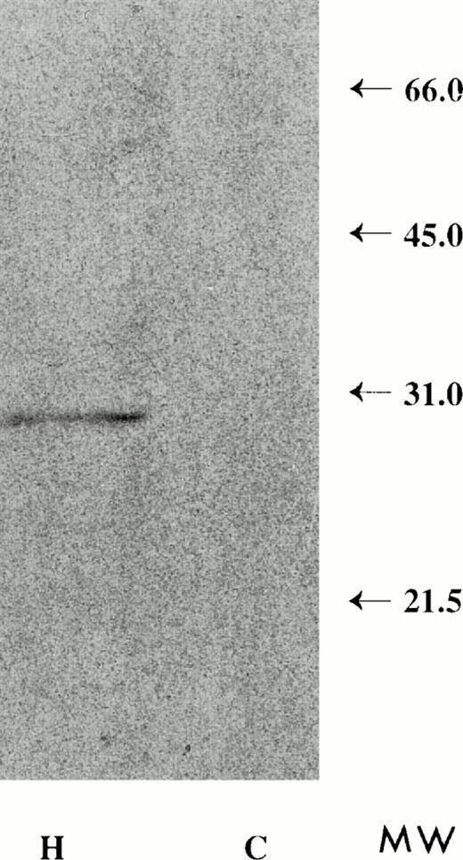 Fig. 14. Detergent extracts of HuT 78 plasma membrane-derived extracellular vesicles, immunoprecipitated with anti-FasL antibody and analyzed by Western blot, produce a 30-kD molecular weight band (H). Detergent extracts of vesicles collected from CX-1 conditioned medium fail to show the 30-kD molecular weight band (C).